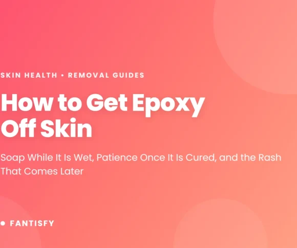 How to get epoxy off skin - soap while it is wet, patience once it is cured, and the rash that comes two days later