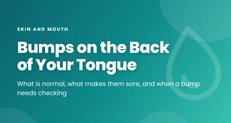 Bumps on the back of the tongue: the normal circumvallate papillae, foliate papillae and lingual tonsil, common causes of sore or white bumps, and when to see a doctor