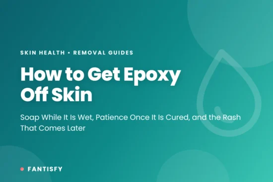 How to get epoxy off skin - soap while it is wet, patience once it is cured, and the rash that comes two days later
