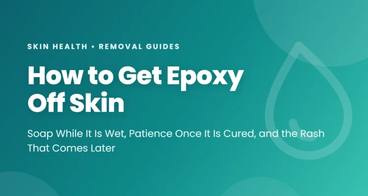 How to get epoxy off skin - soap while it is wet, patience once it is cured, and the rash that comes two days later