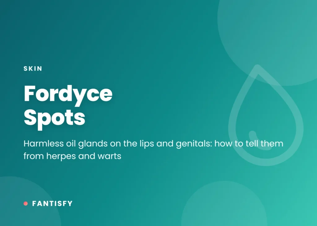 Fordyce spots: tiny pale yellow or white oil glands on the lips and genitals, how common they are, how they differ from herpes and warts, and treatment options