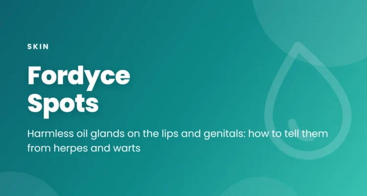 Fordyce spots: tiny pale yellow or white oil glands on the lips and genitals, how common they are, how they differ from herpes and warts, and treatment options