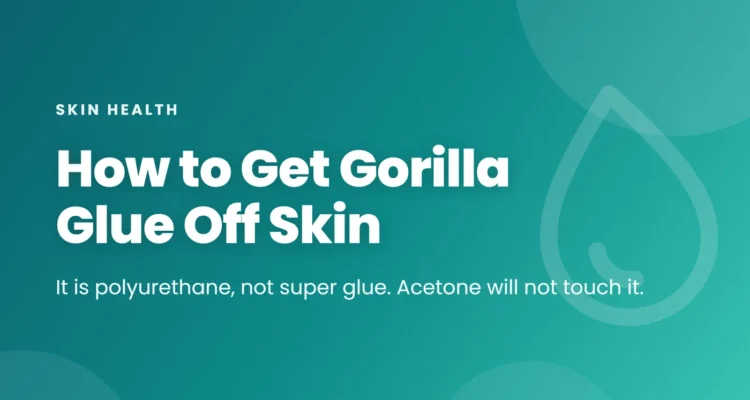 How to Get Gorilla Glue Off Skin article cover on a pink gradient