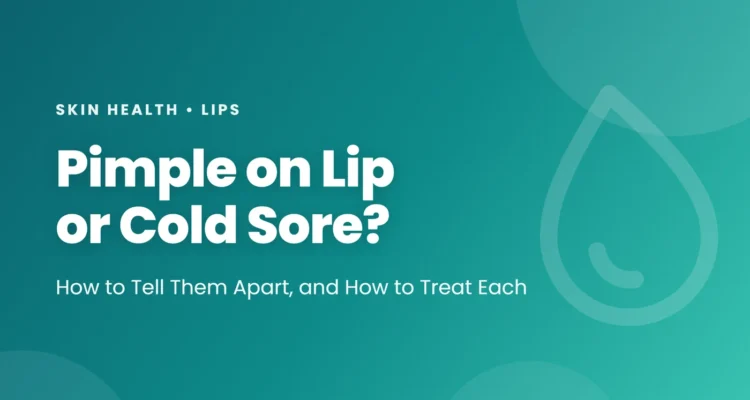 Pimple on lip or cold sore: how to tell a lip pimple from a cold sore, other lip bumps, treatments for each, bumps inside the lip, and when to see a doctor