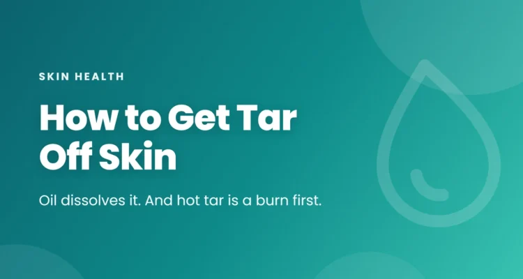 How to Get Tar Off Skin article cover on a pink gradient
